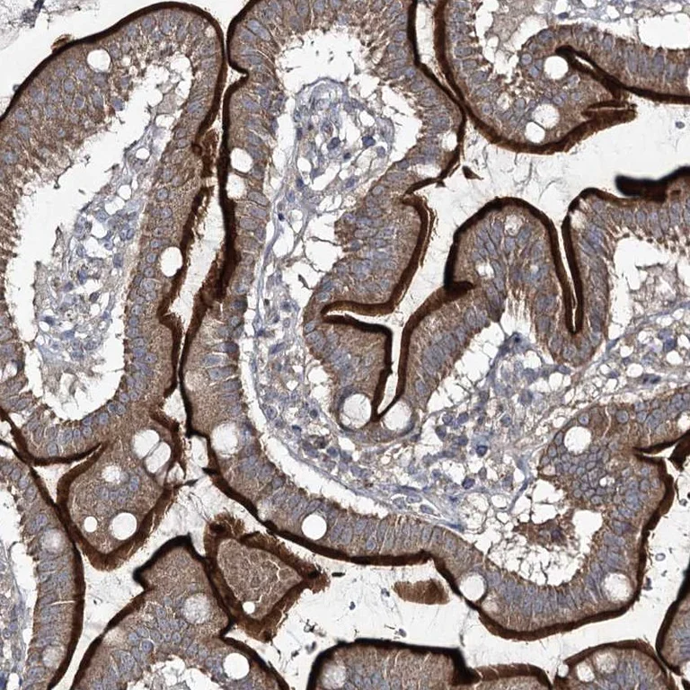Immunohistochemistry (Formalin/PFA-fixed paraffin-embedded sections) - Anti-FANCL antibody (AB272618)