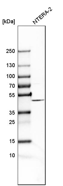 Western blot - Anti-FANCL antibody (AB272618), expandable thumbnail