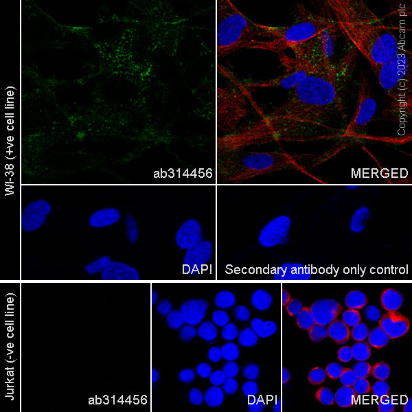 Immunocytochemistry/ Immunofluorescence - Anti-FAP antibody [RM1080] (AB314456), expandable thumbnail