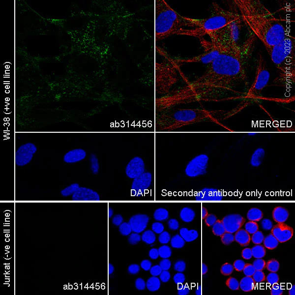 Immunocytochemistry/ Immunofluorescence - Anti-FAP antibody [RM1080] (AB314456)