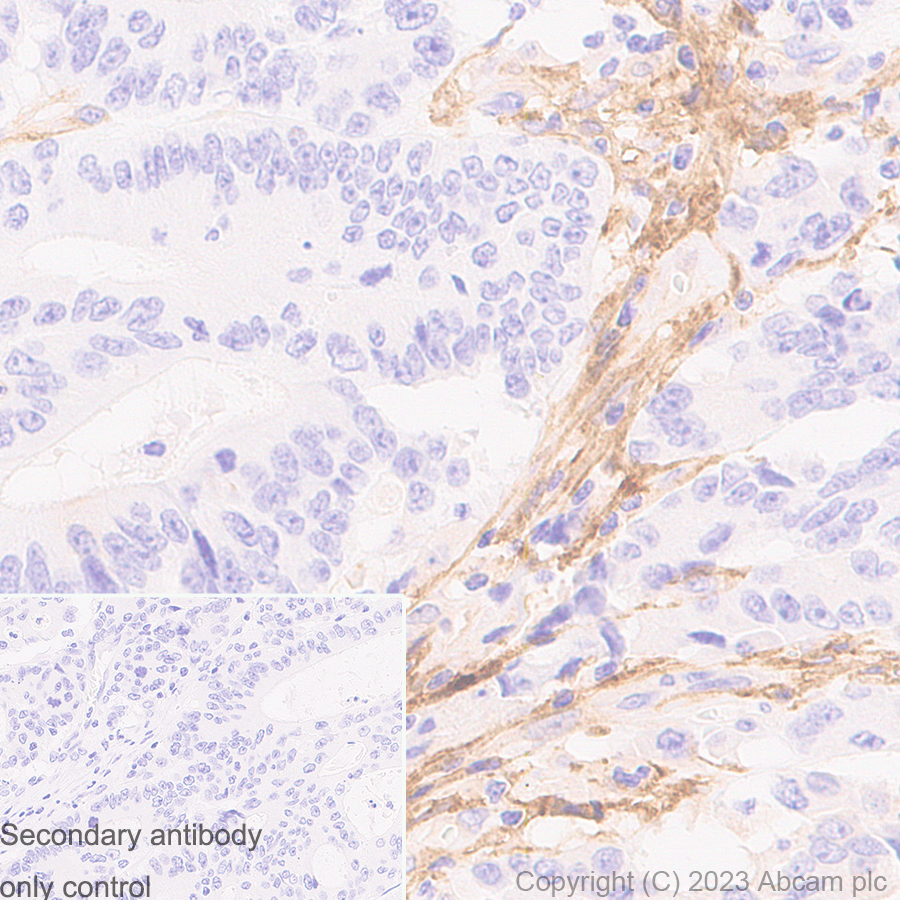 Immunohistochemistry (Formalin/PFA-fixed paraffin-embedded sections) - Anti-FAP antibody [RM1080] (AB314456), expandable thumbnail
