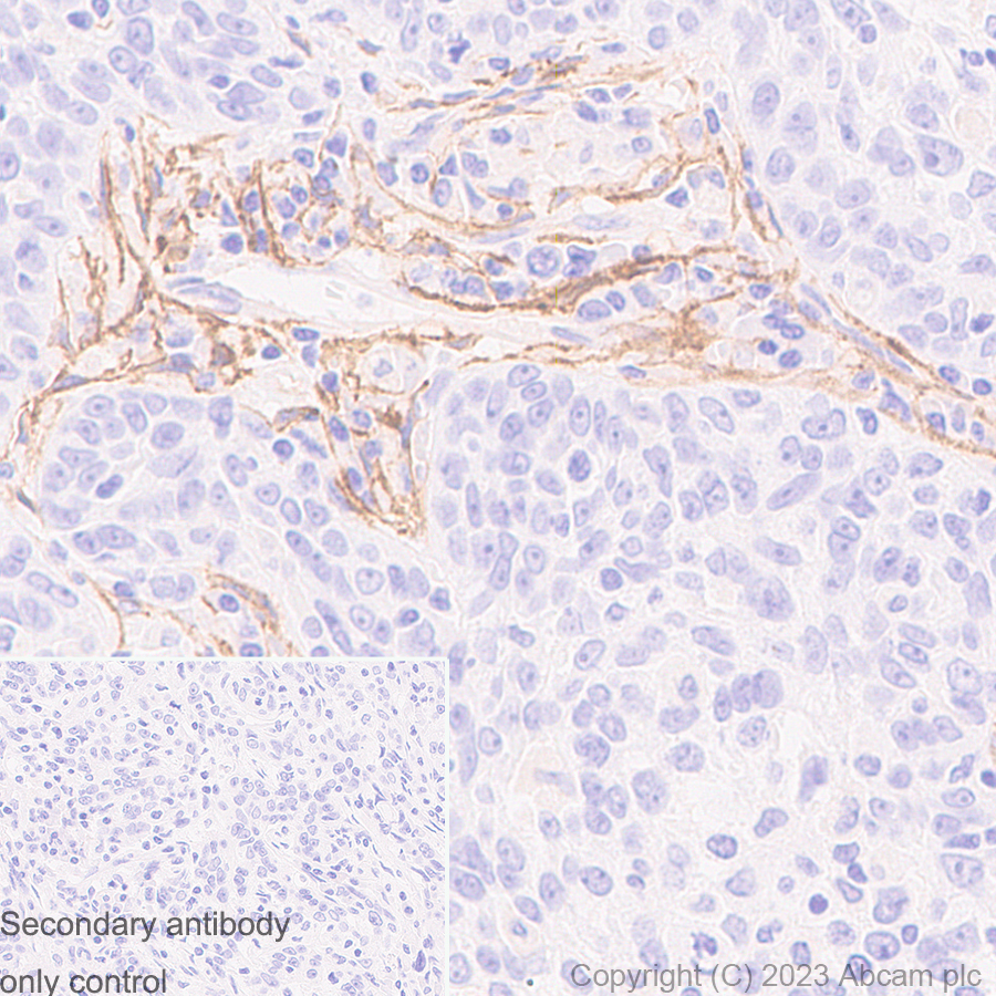 Immunohistochemistry (Formalin/PFA-fixed paraffin-embedded sections) - Anti-FAP antibody [RM1080] (AB314456), expandable thumbnail