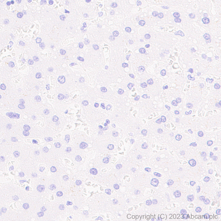 Immunohistochemistry (Formalin/PFA-fixed paraffin-embedded sections) - Anti-FAP antibody [RM1080] (AB314456), expandable thumbnail
