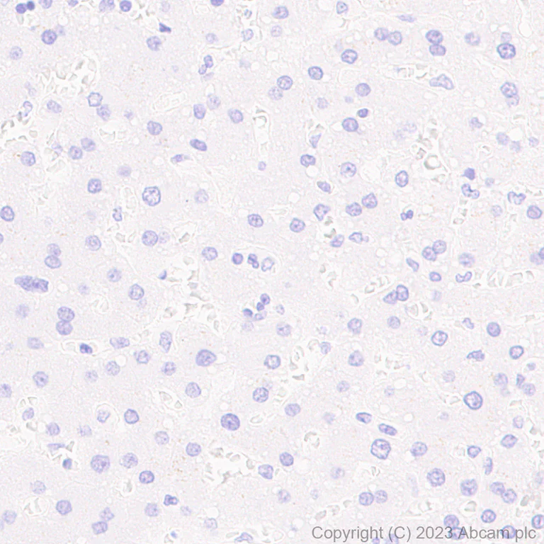Immunohistochemistry (Formalin/PFA-fixed paraffin-embedded sections) - Anti-FAP antibody [RM1080] (AB314456)