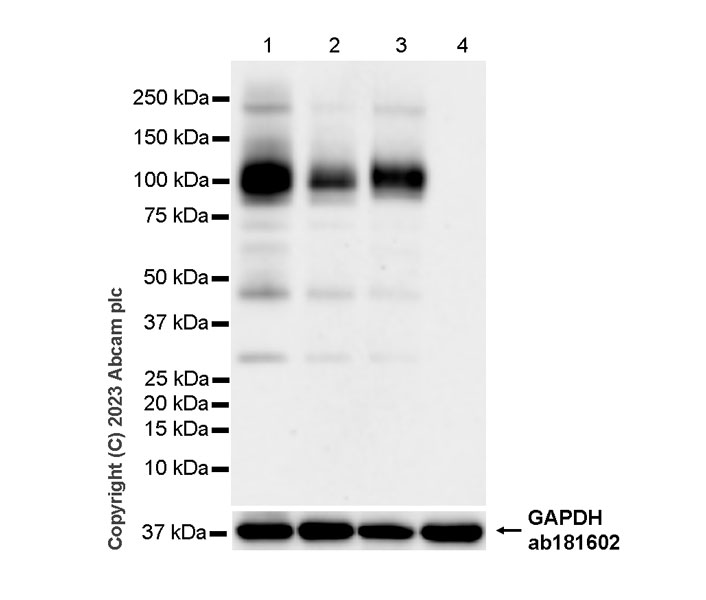 Western blot - Anti-FAP antibody [RM1080] (AB314456), expandable thumbnail