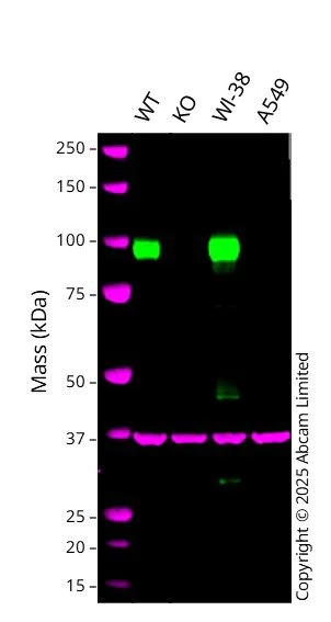 Western blot - Anti-FAP antibody [RM1080] (AB314456)