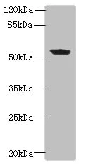 Western blot - Anti-FAPP2 antibody (AB235300)