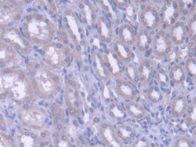 Immunohistochemistry (Formalin/PFA-fixed paraffin-embedded sections) - Anti-FARS2 antibody (ab231190), expandable thumbnail