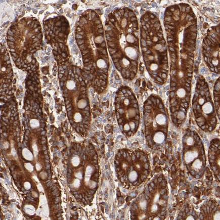 Immunohistochemistry (Formalin/PFA-fixed paraffin-embedded sections) - Anti-FARSLA antibody (AB224049)