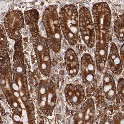 Immunohistochemistry (Formalin/PFA-fixed paraffin-embedded sections) - Anti-FARSLA antibody (AB224049)