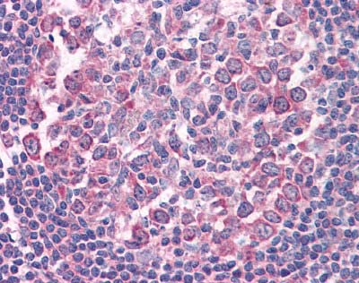 Immunohistochemistry (Formalin/PFA-fixed paraffin-embedded sections) - Anti-Fas antibody (AB110021), expandable thumbnail