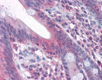 Immunohistochemistry (Formalin/PFA-fixed paraffin-embedded sections) - Anti-Fas antibody (AB110021), expandable thumbnail