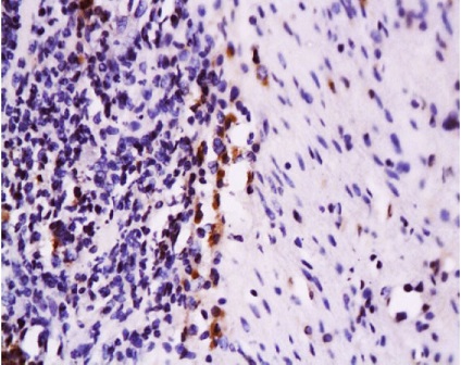 Immunohistochemistry (Formalin/PFA-fixed paraffin-embedded sections) - Anti-Fas antibody (AB216636)