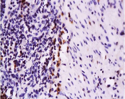 Immunohistochemistry (Formalin/PFA-fixed paraffin-embedded sections) - Anti-Fas antibody (AB216636)