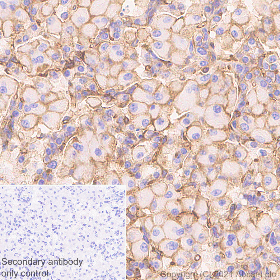 Immunohistochemistry (Formalin/PFA-fixed paraffin-embedded sections) - Anti-Fas antibody [EPR24898-74] (AB271016), expandable thumbnail