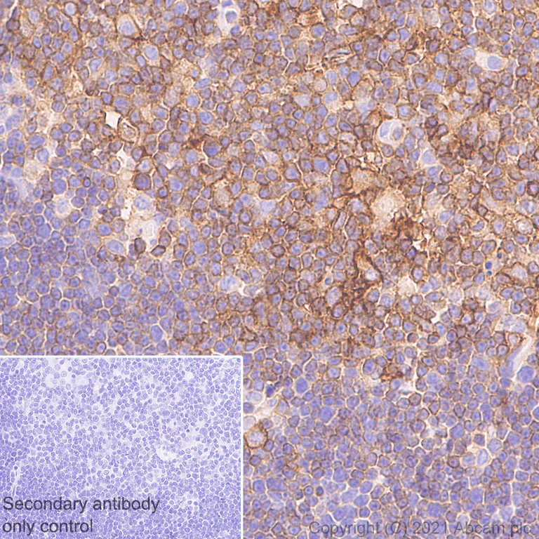 Immunohistochemistry (Formalin/PFA-fixed paraffin-embedded sections) - Anti-Fas antibody [EPR24898-74] - BSA and Azide free (AB289892)