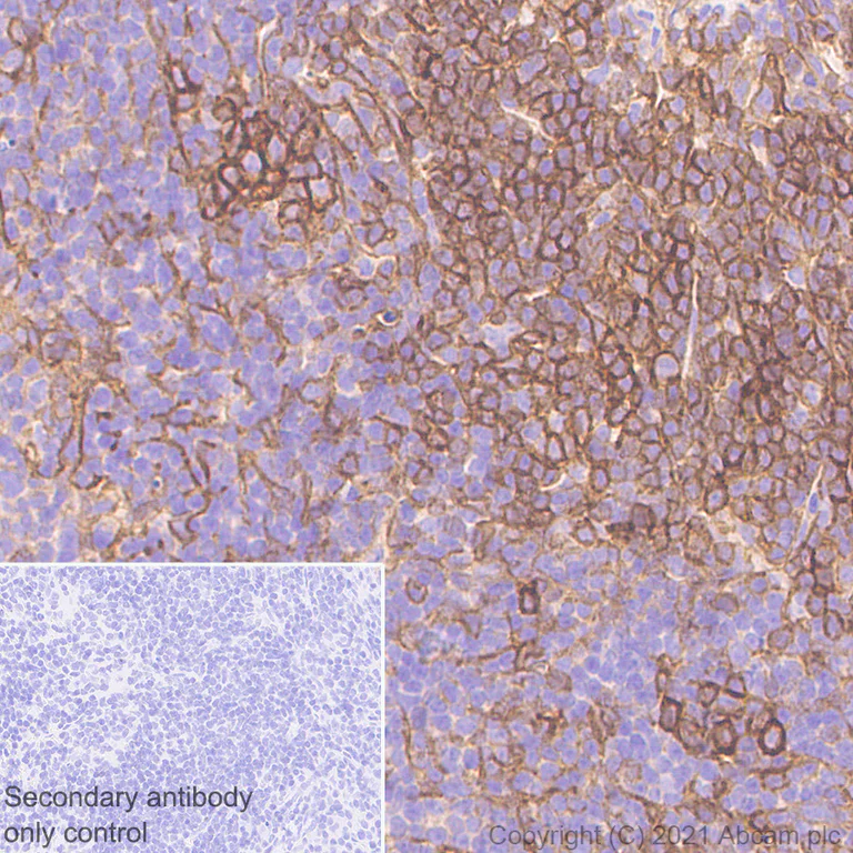 Immunohistochemistry (Formalin/PFA-fixed paraffin-embedded sections) - Anti-Fas antibody [EPR24898-74] - BSA and Azide free (AB289892)