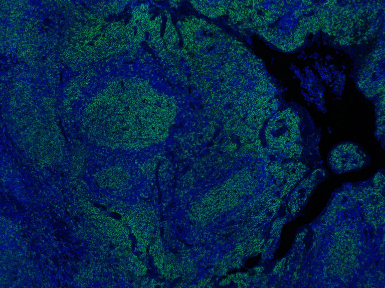 Immunohistochemistry (Formalin/PFA-fixed paraffin-embedded sections) - Anti-Fas antibody [EPR5700] (AB133619)