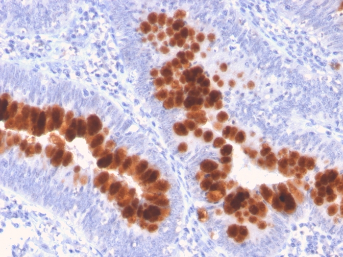 Immunohistochemistry (Formalin/PFA-fixed paraffin-embedded sections) - Anti-Fas antibody [FAS/3112] - BSA and Azide free (AB269685), expandable thumbnail