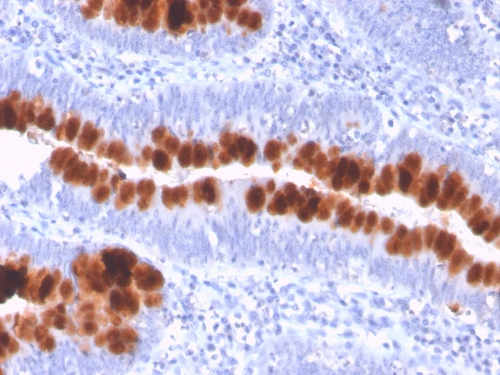 Immunohistochemistry (Formalin/PFA-fixed paraffin-embedded sections) - Anti-Fas antibody [FAS/3112] - BSA and Azide free (AB269685)