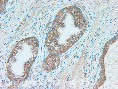 Immunohistochemistry (Formalin/PFA-fixed paraffin-embedded sections) - Anti-Fas Ligand antibody (AB134401)