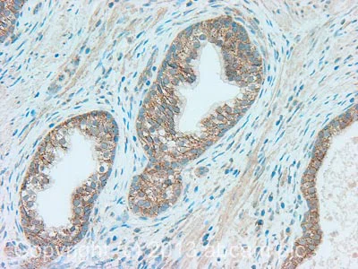 Immunohistochemistry (Formalin/PFA-fixed paraffin-embedded sections) - Anti-Fas Ligand antibody (AB134401)