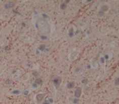 Immunohistochemistry (Formalin/PFA-fixed paraffin-embedded sections) - Anti-Fascin 2 antibody (AB232768)