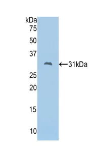 Western blot - Anti-Fascin 2 antibody (AB232768)