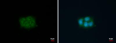 Immunocytochemistry/ Immunofluorescence - Anti-Fascin antibody (AB183891)