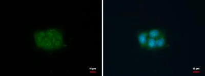 Immunocytochemistry/ Immunofluorescence - Anti-Fascin antibody (AB183891)
