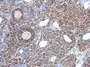 Immunohistochemistry (Formalin/PFA-fixed paraffin-embedded sections) - Anti-Fascin antibody (AB183891)