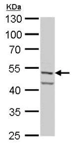 Western blot - Anti-Fascin antibody (AB183891)