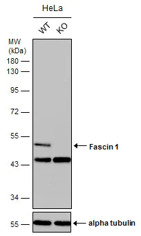 Western blot - Anti-Fascin antibody (AB183891)