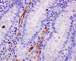 Immunohistochemistry (Formalin/PFA-fixed paraffin-embedded sections) - Anti-Fascin antibody [EP5902] (AB126772)