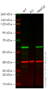 Western blot - Anti-Fascin antibody [EP5902] (AB126772)