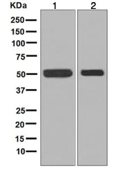 Western blot - Anti-Fascin antibody [EP5902] (AB126772)
