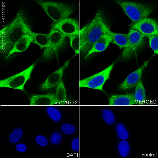 Immunocytochemistry/ Immunofluorescence - Anti-Fascin antibody [EP5902] - BSA and Azide free (AB240034)
