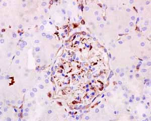 Immunohistochemistry (Formalin/PFA-fixed paraffin-embedded sections) - Anti-Fascin antibody [EP5902] - BSA and Azide free (AB240034)