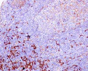 Immunohistochemistry (Formalin/PFA-fixed paraffin-embedded sections) - Anti-Fascin antibody [EP5902] - BSA and Azide free (AB240034)