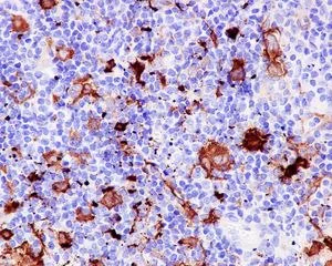 Immunohistochemistry (Formalin/PFA-fixed paraffin-embedded sections) - Anti-Fascin antibody [EP5902] - BSA and Azide free (AB240034)