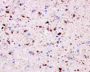 Immunohistochemistry (Formalin/PFA-fixed paraffin-embedded sections) - Anti-Fascin antibody [EP5902] - BSA and Azide free (AB240034)