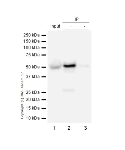 Immunoprecipitation - Anti-Fascin antibody [EP5902] - BSA and Azide free (AB240034)