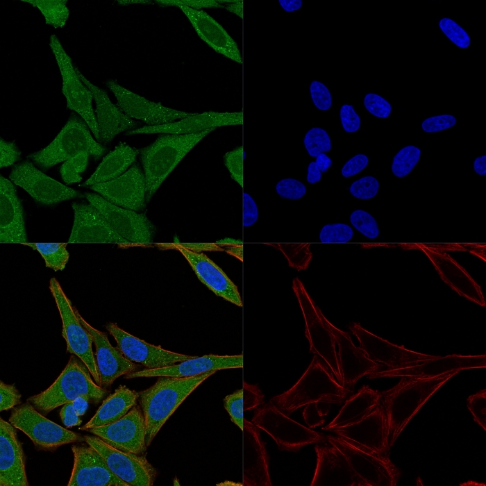 Immunocytochemistry - Anti-Fascin antibody [FSCN1/417] (AB220195), expandable thumbnail