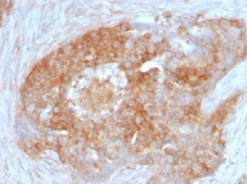 Immunohistochemistry (Formalin/PFA-fixed paraffin-embedded sections) - Anti-Fascin antibody [FSCN1/417] (AB220195), expandable thumbnail