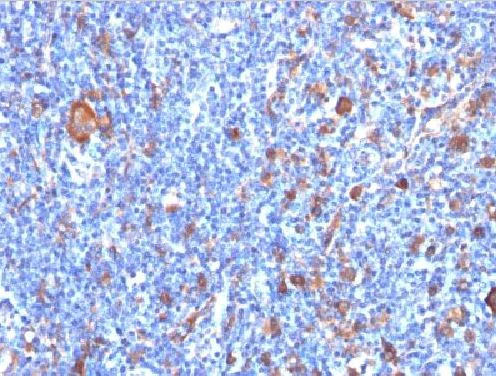 Immunohistochemistry (Formalin/PFA-fixed paraffin-embedded sections) - Anti-Fascin antibody [FSCN1/417] (AB220195)