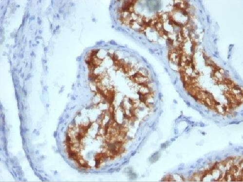 Immunohistochemistry (Formalin/PFA-fixed paraffin-embedded sections) - Anti-Fascin antibody [FSCN1/417] (ab220195), expandable thumbnail