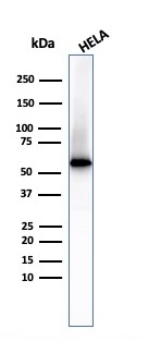 Western blot - Anti-Fascin antibody [FSCN1/417] (AB220195), expandable thumbnail