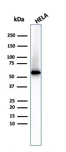 Western blot - Anti-Fascin antibody [FSCN1/417] (AB220195)