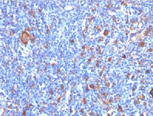 Immunohistochemistry (Formalin/PFA-fixed paraffin-embedded sections) - Anti-Fascin antibody [FSCN1/417] - BSA and Azide free (AB212840)