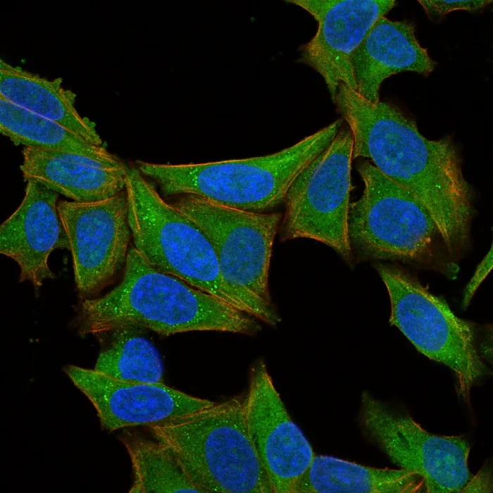 Immunocytochemistry - Anti-Fascin antibody [SPM133] - BSA and Azide free (AB212841)